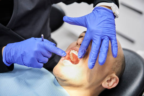 Best Emergency Dentist for Lost Fillings or Crowns in Union Hill Novelty Hill, WA