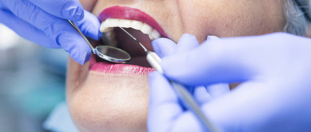 Best Emergency Dentist for Knocked-Out Tooth in Union Hill Novelty Hill, WA